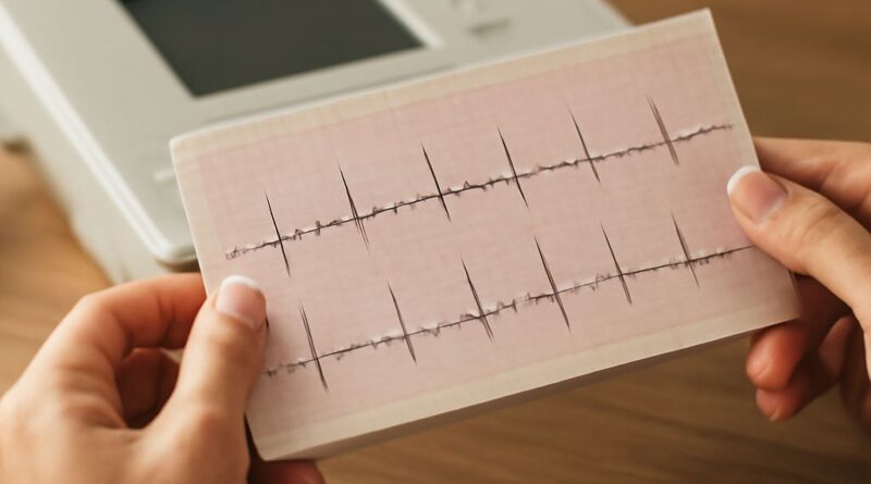 Sinus Rhythm EKG and Natural Antibiotics for Sinus Infections