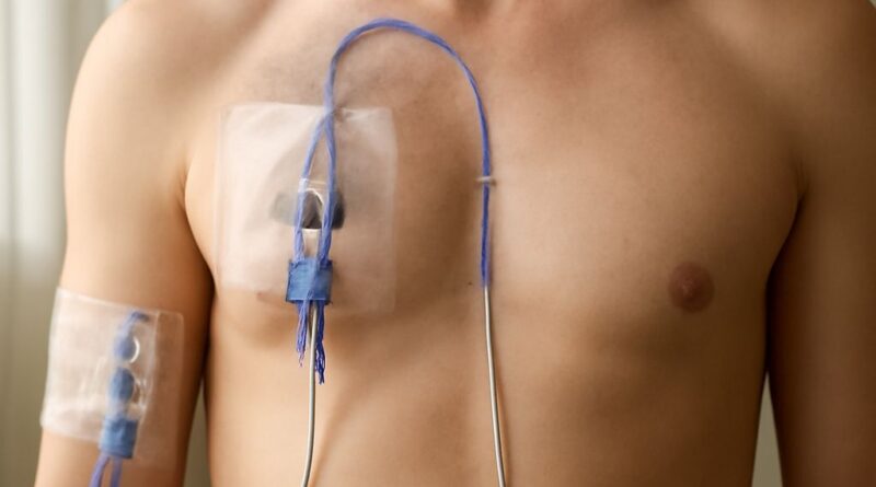 IV catheter and midline catheter comparison