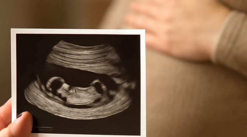 12 week ultrasound pictures and ultrasound baby pictures
