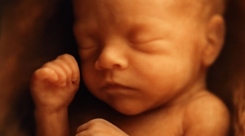 Sinai Urgent Care ultrasound boy vs girl baby