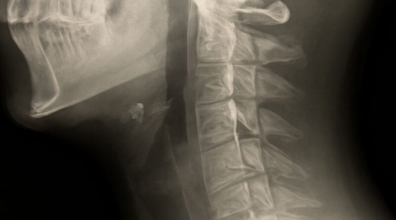 Neck MRI and MRI Neck Procedure
