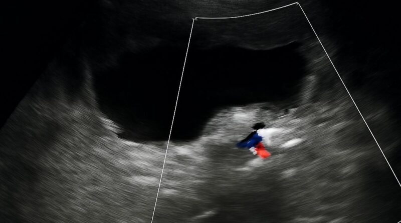 Abnormal ultrasound and kidney ultrasound findings