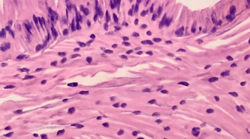 Diagnostic pathology and pathology report analysis