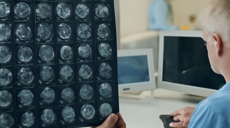 MRI cancer scan showing imaging differences between CT scan vs MRI